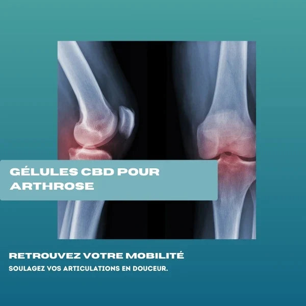 Gélule CBD pour arthrose